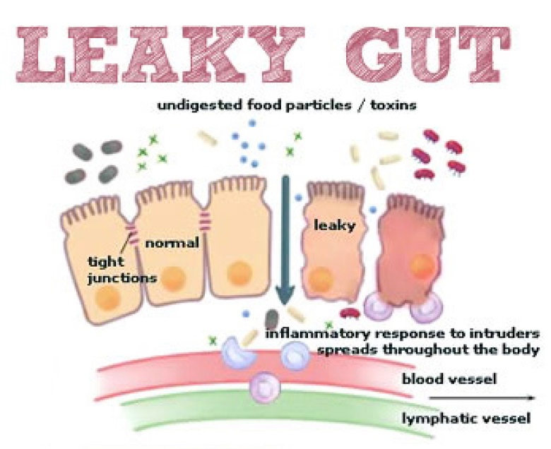 leaky-Gut