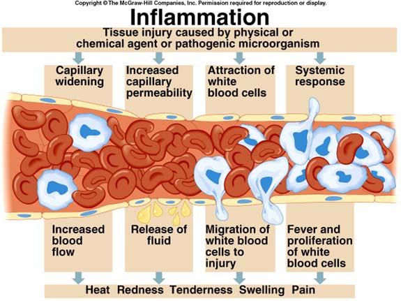 inflammation-diagram